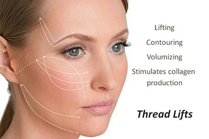 Instagram post by Dr. Pamela R. Lipkin: Let’s Talk about Threads.... A thread lift is a type of procedure wherein temporary sutures are used to produce a subtle but visible "lift" …