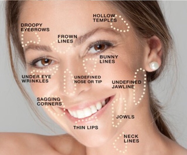 Instagram post by Dr. Pamela R. Lipkin: We understand that going under the Knife can be nerve wracking, Have you ever considered a Liquid Facelift?.... Little to Zero down time and…
