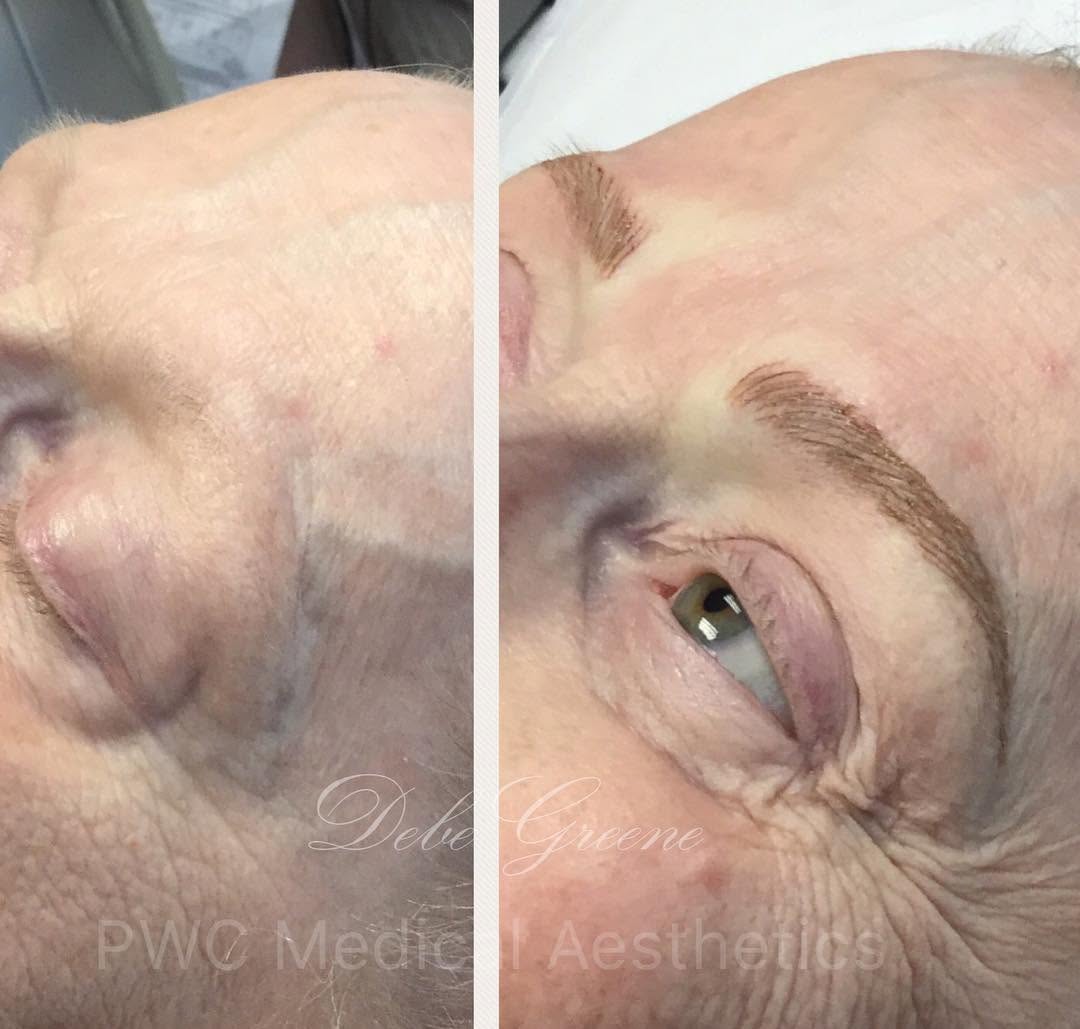 Instagram post by Dr. Patricia Faraz: I am so lucky to work with such beautiful ladies ❤️ #microblading #microbladedbrows #permanentmakeup #beforeandafter #beautiful