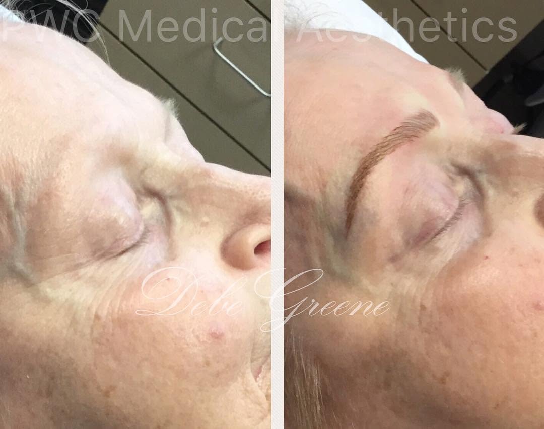 Instagram post by Dr. Patricia Faraz: #microblading #microbladedbrows #beforeandafter #beauty