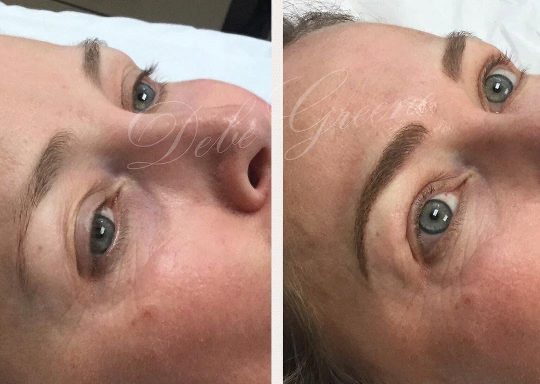 Instagram post by Dr. Patricia Faraz: #microblading #microbladingeyebrows #permanenteyebrows #beforeandafter #beautiful