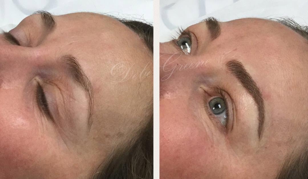 Instagram post by Dr. Patricia Faraz: #microbladedbrows #microbladingeyebrows #permanentmakeup #beauty #beforeandafter