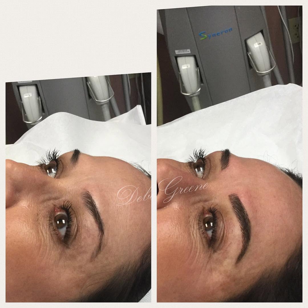 Instagram post by Dr. Patricia Faraz: #microblading #microbladedbrows #beforeandafter #beauty