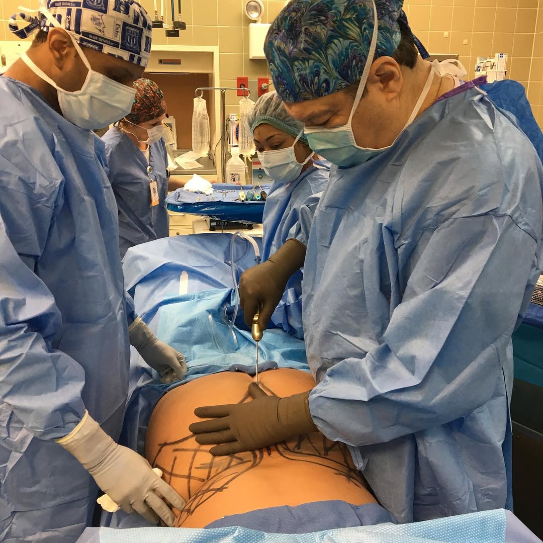 Instagram post by Dr. Patricia L. Eby: Bringing in 2021 with mommy makeovers! #liposuction #mastopexy #fatgraftingbreasts #tummytuck #memphis @thebeautydoctors.com