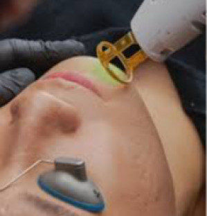 Instagram post by Dr. Patrick J. Budny: Have you ever heard of the saying, "not by the hair of my chinny, chin, chin?" Well, we totally get it - unwanted facial hair can be a hassl…