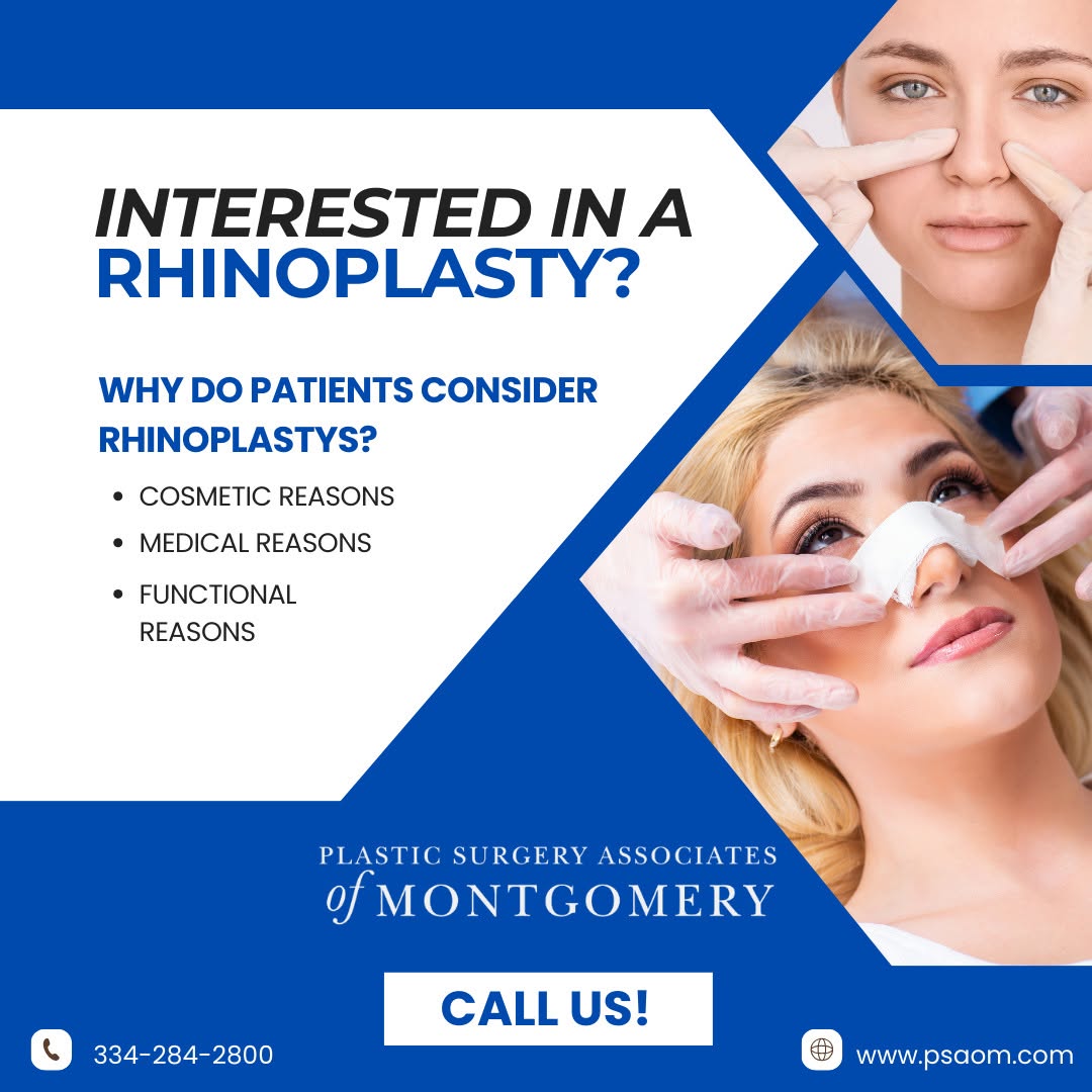 Instagram post by Dr. Patrick J. Budny: Patients consider rhinoplasty surgery for a variety of reasons. 🏥 Some may want to improve the appearance of their nose for aesthetic purpo…