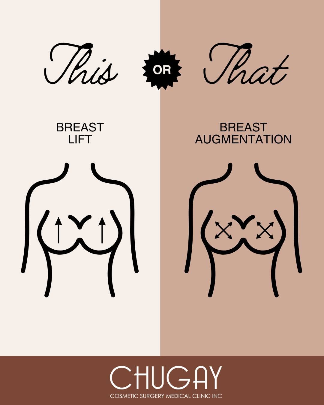 Instagram post by Dr. Paul Chugay: What's the difference between breast lift and breast augmentation? Here's a simple breakdown. ✨ Breast Lift Best for: Lifting sagging tissue…