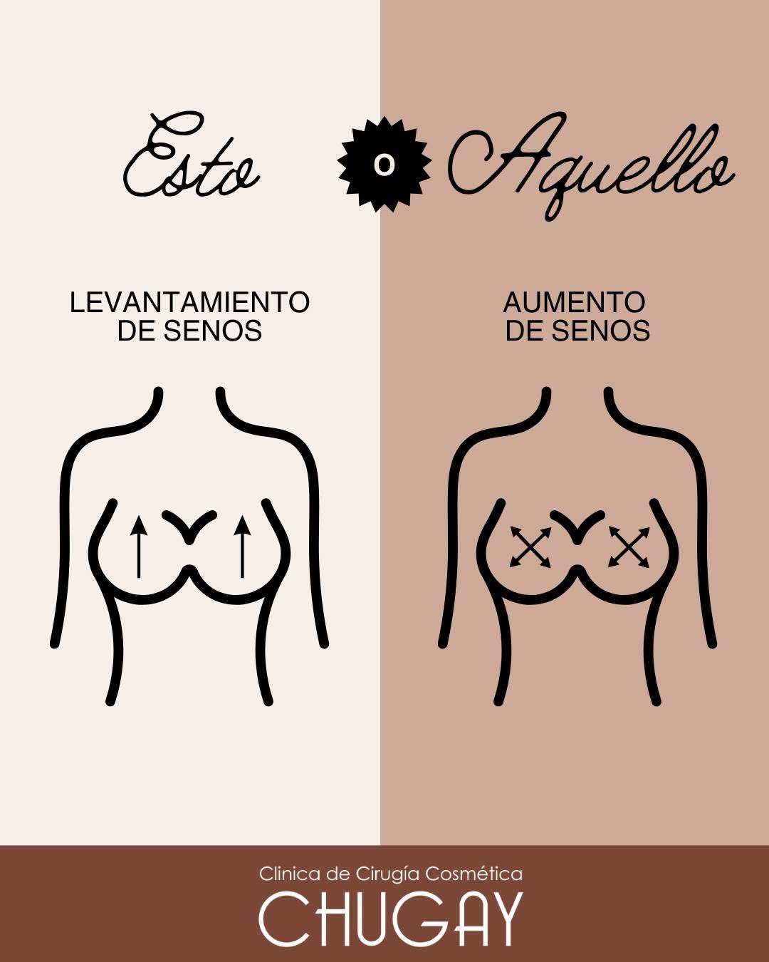 Instagram post by Dr. Paul Chugay: ¿Cuál es la diferencia entre un levatamiento de senos y un aumento de senos? Aquí tienes una explicación. ✨ Levantamiento de senos Ideal par…