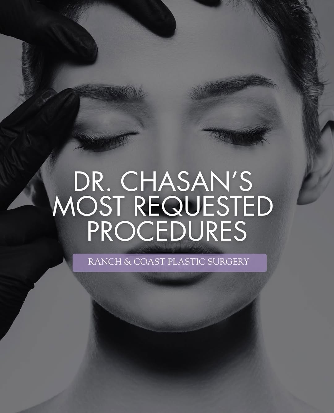 Instagram post by Dr. Paul E. Chasan: What are patients requesting most? From rhinoplasty and breast surgery to facelifts, Thong Lifts, and tummy tucks, Dr. Chasan’s most request…