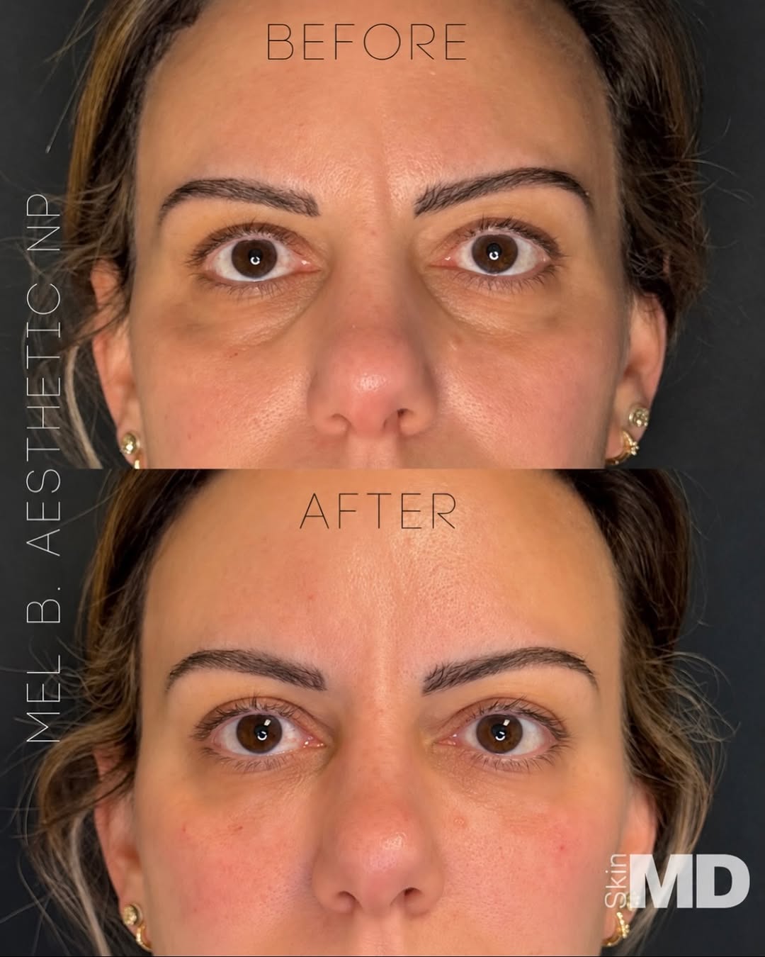 Instagram post by Dr. Paul Flashner: it’s giving brighter, refreshed, natural, youthful, and well-rested. 📍 SkinMD Boston + North Shore 💻 https://skinmd1.com/schedule/ 📞 (617…