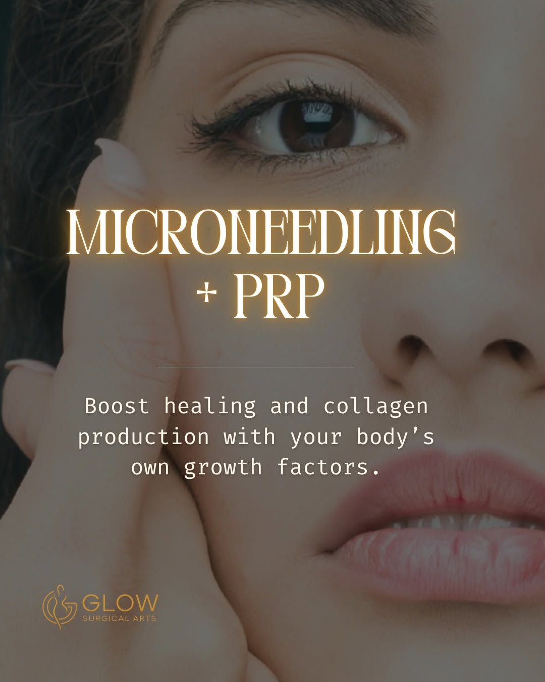 Instagram post by Dr. Paul Gorman: ✨ Reveal smoother, firmer, more radiant skin with the power of Microneedling + PRP! ✨ This advanced treatment combines collagen-stimulating …