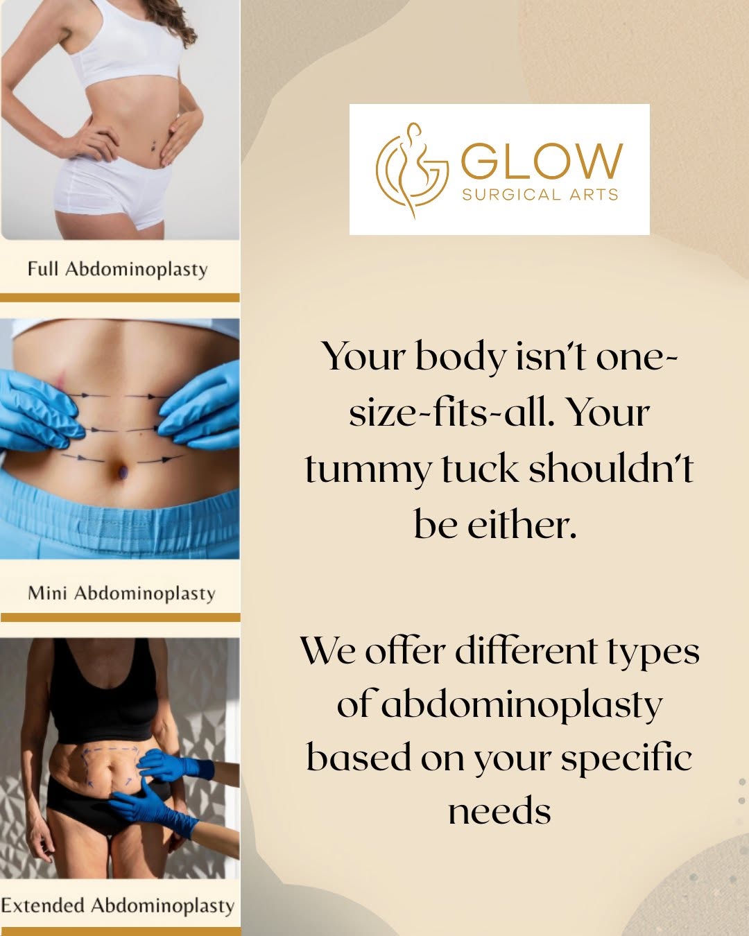 Instagram post by Dr. Paul Gorman: At GLOW Surgical Arts, Dr. Paul Gorman offers multiple types of abdominoplasty, carefully tailored to your body and your goals: 🔹 Mini Abdo…
