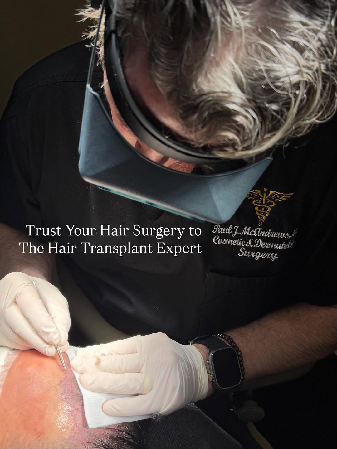 Instagram post by Dr. Paul J. McAndrews: Paul J. McAndrews, M.D. is the authority & expert in the field of FUT & FUE hair transplant surgery. 👨⚕️1. Exceptional Medical & Academic …