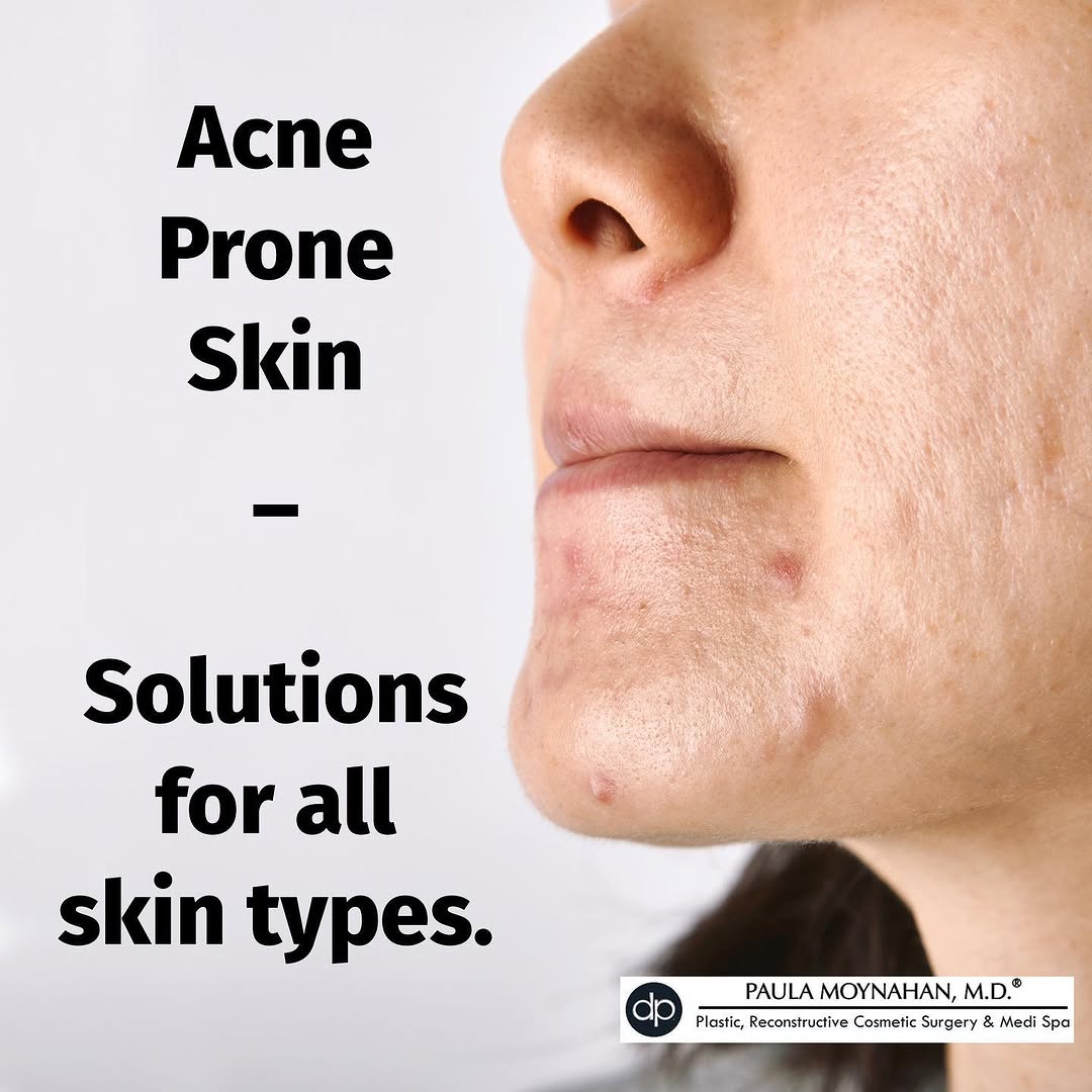 Instagram post by Dr. Paula Moynahan: Top-Rated Products | Proven Treatments 🌟🌟🌟 Clearer, healthier, acne-free skin is now within your reach contact our office today to book y…