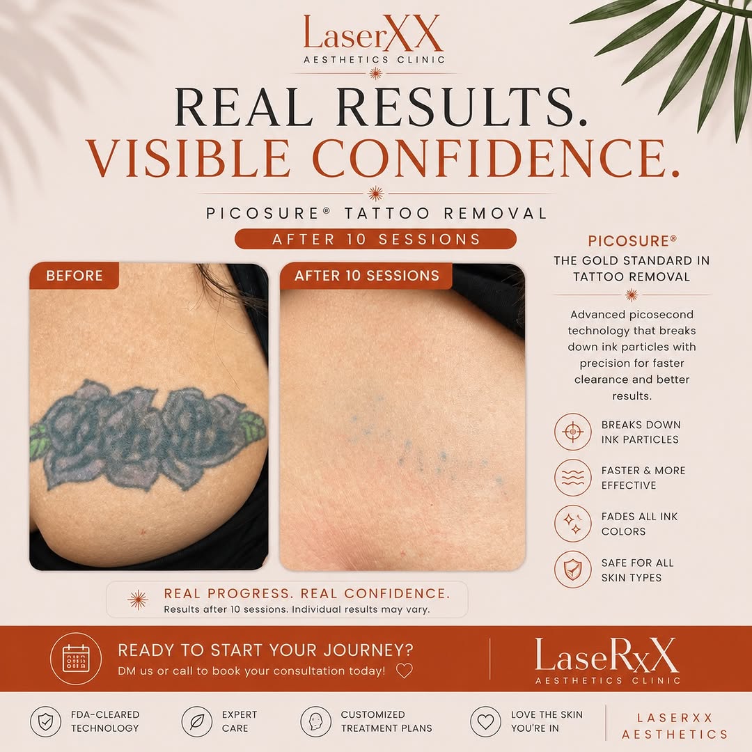 Instagram post by Dr. Peiman Berdjis: ✨ REAL RESULTS. VISIBLE CONFIDENCE. ✨ This PicoSure® tattoo removal result after 10 sessions shows what consistent treatments and patience c…