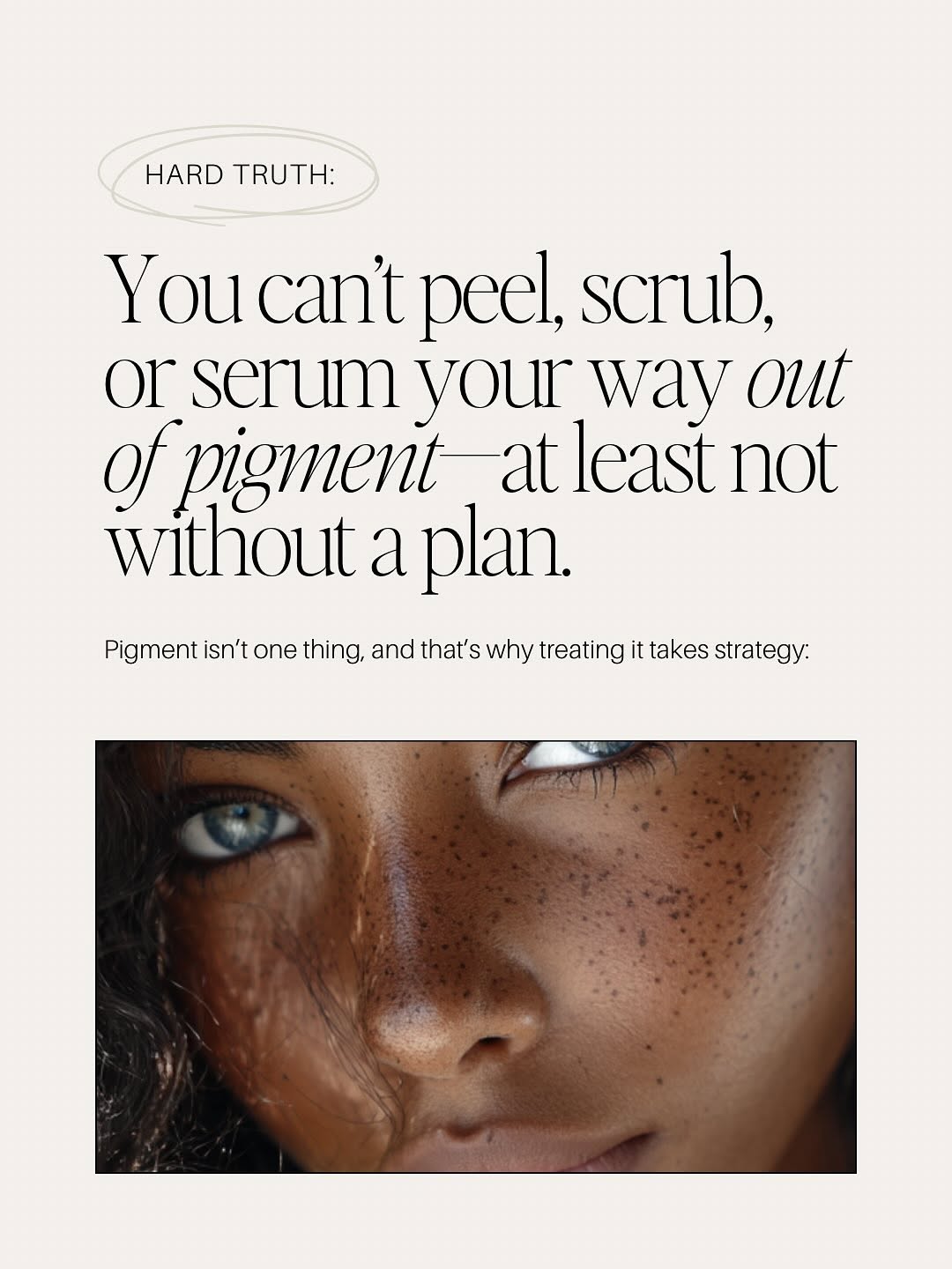 Instagram post by Dr. Peter A.D. Rubin: Pigment isn’t just about what you see on the surface—it’s what’s happening beneath the skin. 🌿 Sun, heat, hormones, and inflammation all pl…
