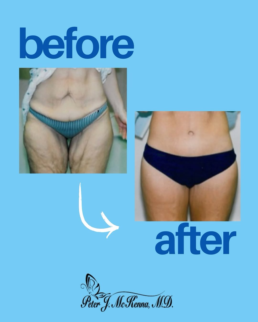 Instagram post by Dr. Peter McKenna: Real results, tailored to the individual. Dr. McKenna works with each patient to create a personalized treatment plan designed to enhance th…