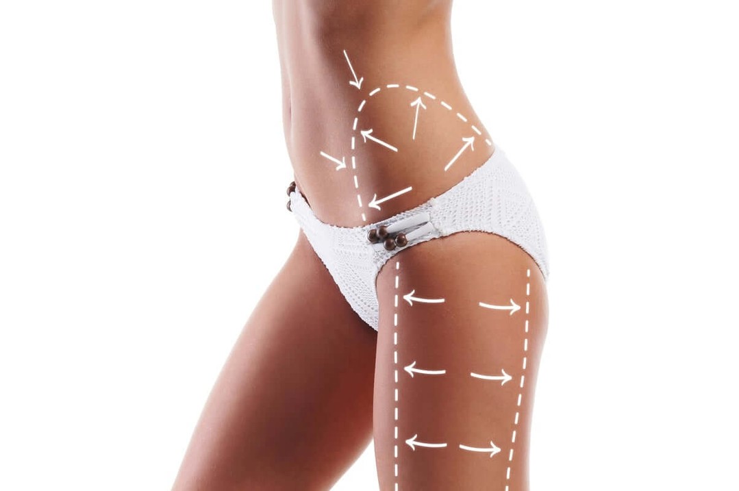 Instagram post by Dr. Phillip Dahan: Contour Your Body to Perfection with Reno's Finest—Dr. Phillip Dahan https://www.cosmeticsurgeryinreno.com/blog?p=contour-your-body-to-perfe…