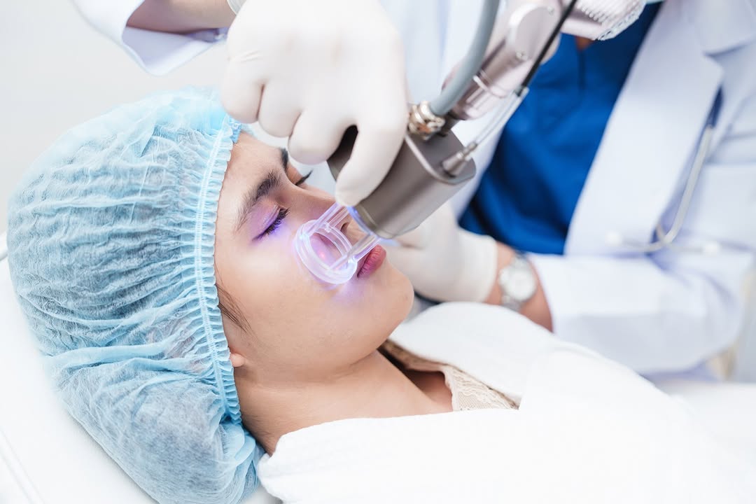 Instagram post by Dr. Pradeep S. Mohan: Rejuvenate your skin with laser skin resurfacing at Veda Medical. Our advanced laser technology helps reduce fine lines, scars, and uneven s…