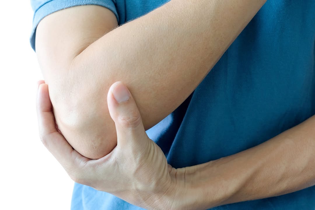 Instagram post by Dr. Pradeep S. Mohan: Cubital Tunnel Syndrome requires expert care, and Veda Medical is here to help. Our skilled team provides personalized treatment options to …