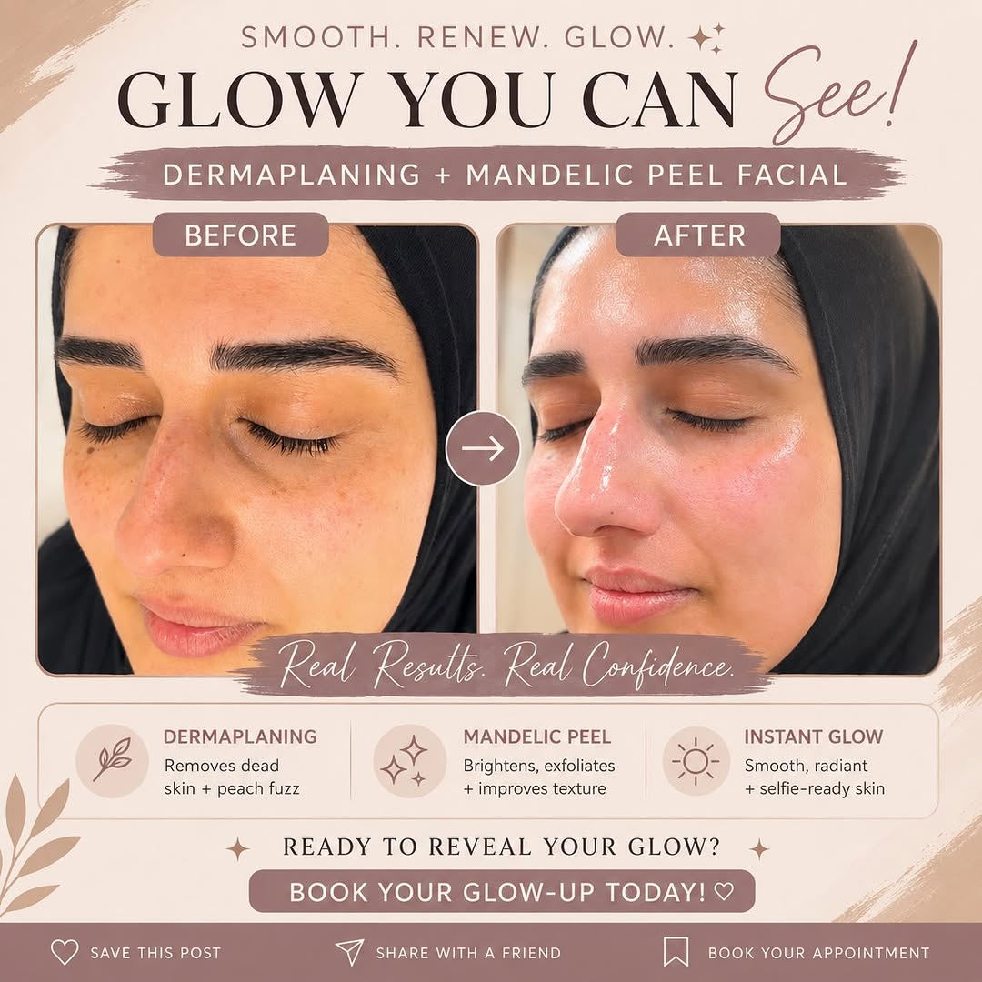 Instagram post by Dr. Priti P. Patel: ✨ WHY WE LOVE THIS COMBO ✨ Dermaplaning + Mandelic Peel = the ultimate glow-up duo 🤎✨ We LOVE dermaplaning because it gently removes the bu…