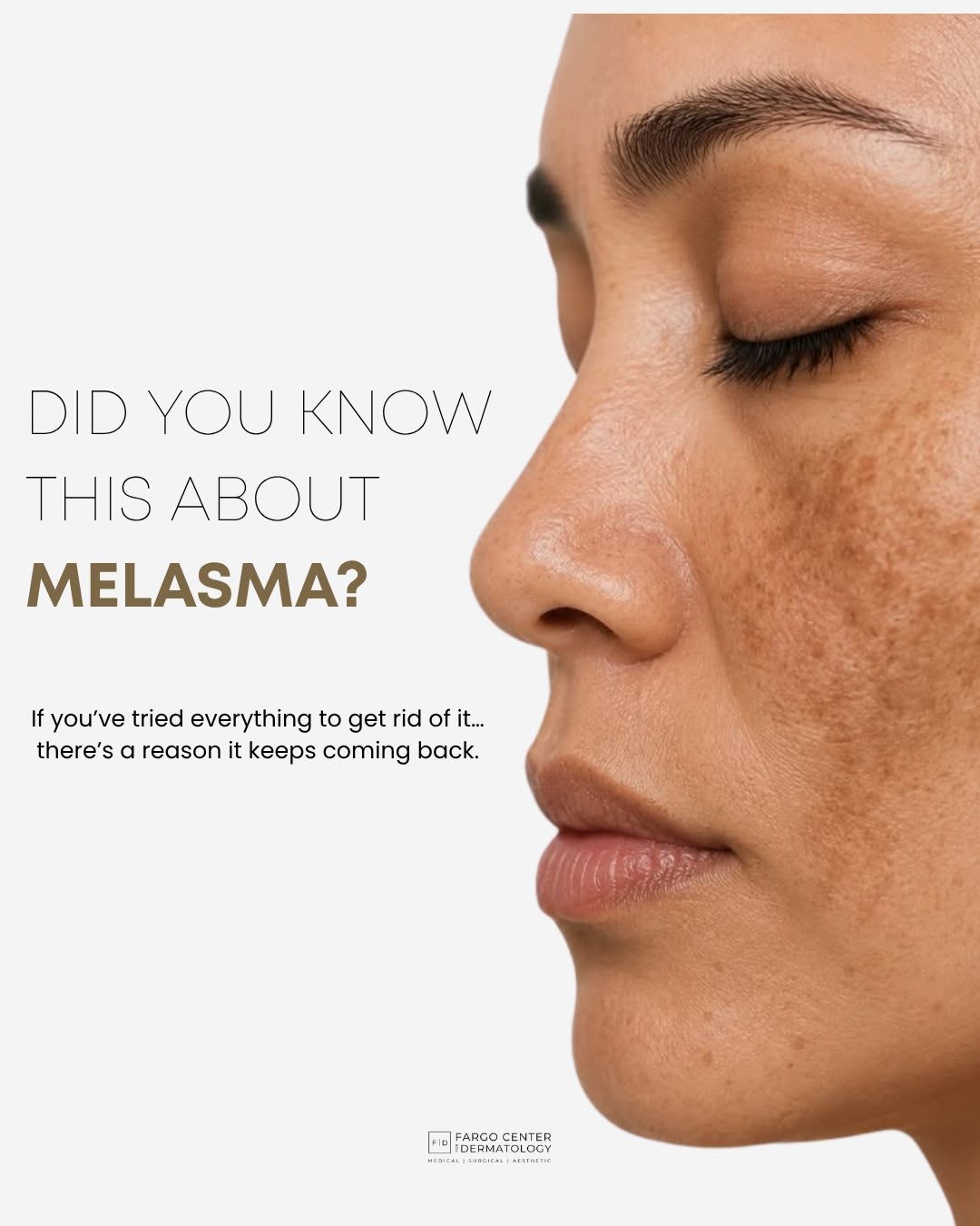 Instagram post by Dr. Rachel Ness: Melasma isn’t just “dark spots” and treating it like ordinary pigmentation can be why it keeps coming back. 👀 Hormones, heat, sun exposure,…