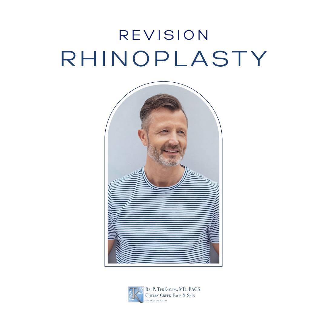 Instagram post by Dr. Raj P. TerKonda: FAQ | How long should I wait after my original rhinoplasty? 💭 . It is crucial to allow your nose time to heal following a rhinoplasty. It c…