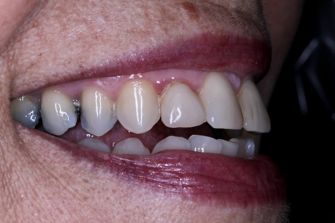 Instagram post by Dr. Ramin Tabib: Big smile. Now look to the camera