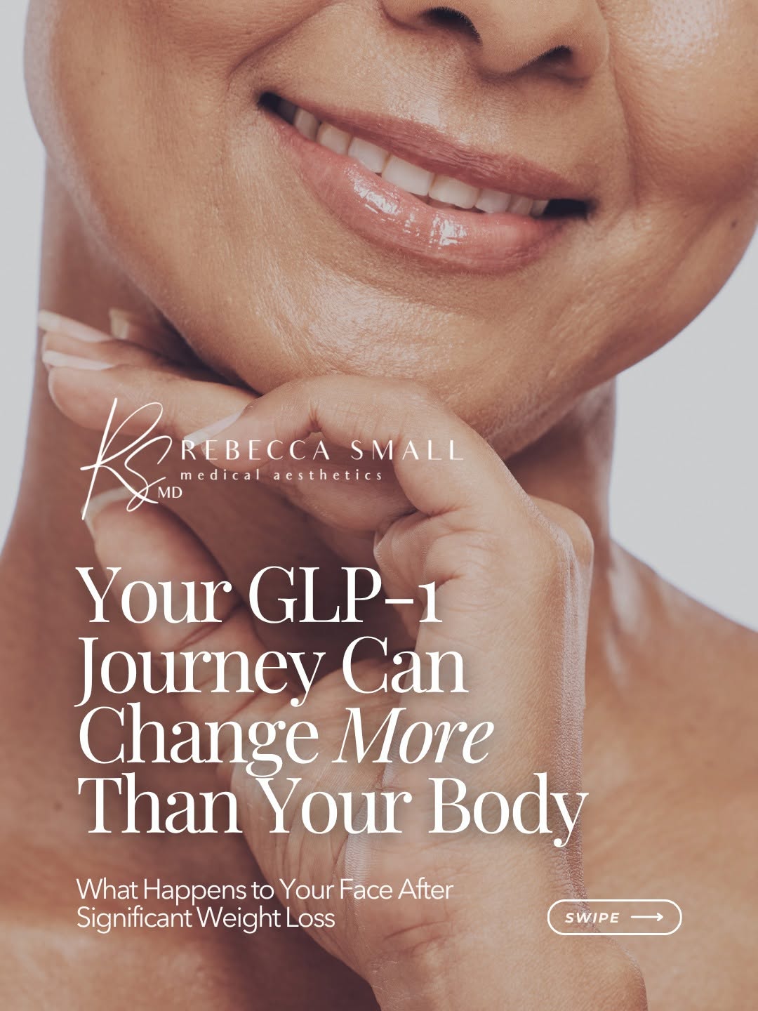 Instagram post by Dr. Rebecca Small: When your body changes, your face can change too. Significant weight loss can sometimes lead to changes in facial contours, volume, and skin…