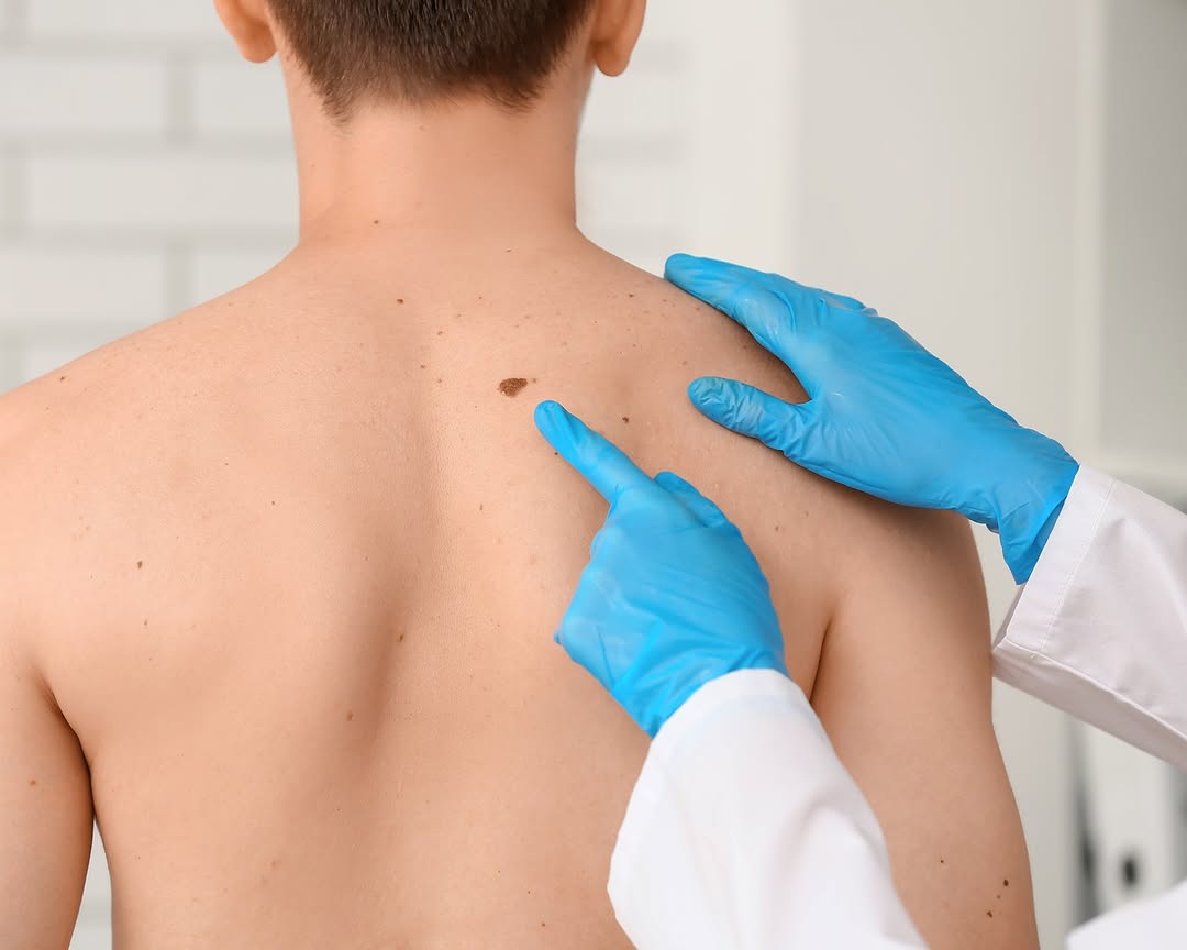 Instagram post by Dr. Rebecca Tung: #TuesdayTips: Do you know your family history when it comes to melanoma? About 1 in 10 people diagnosed with melanoma have a family member w…