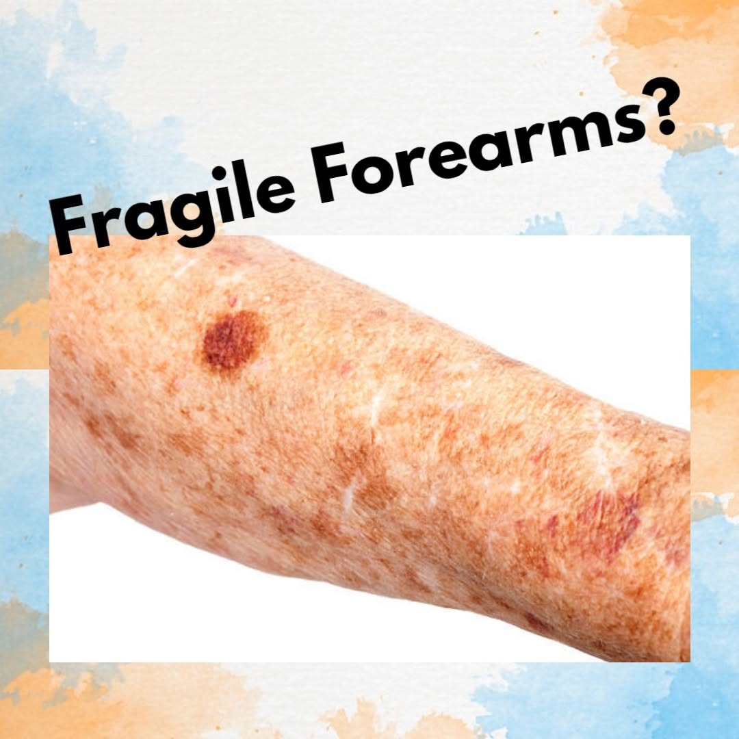 Instagram post by Dr. Rhoda Narins: As you get older skin gets more fragile. Any number of factors can cause our skin to begin showing its age; sometimes even prematurely. Whet…