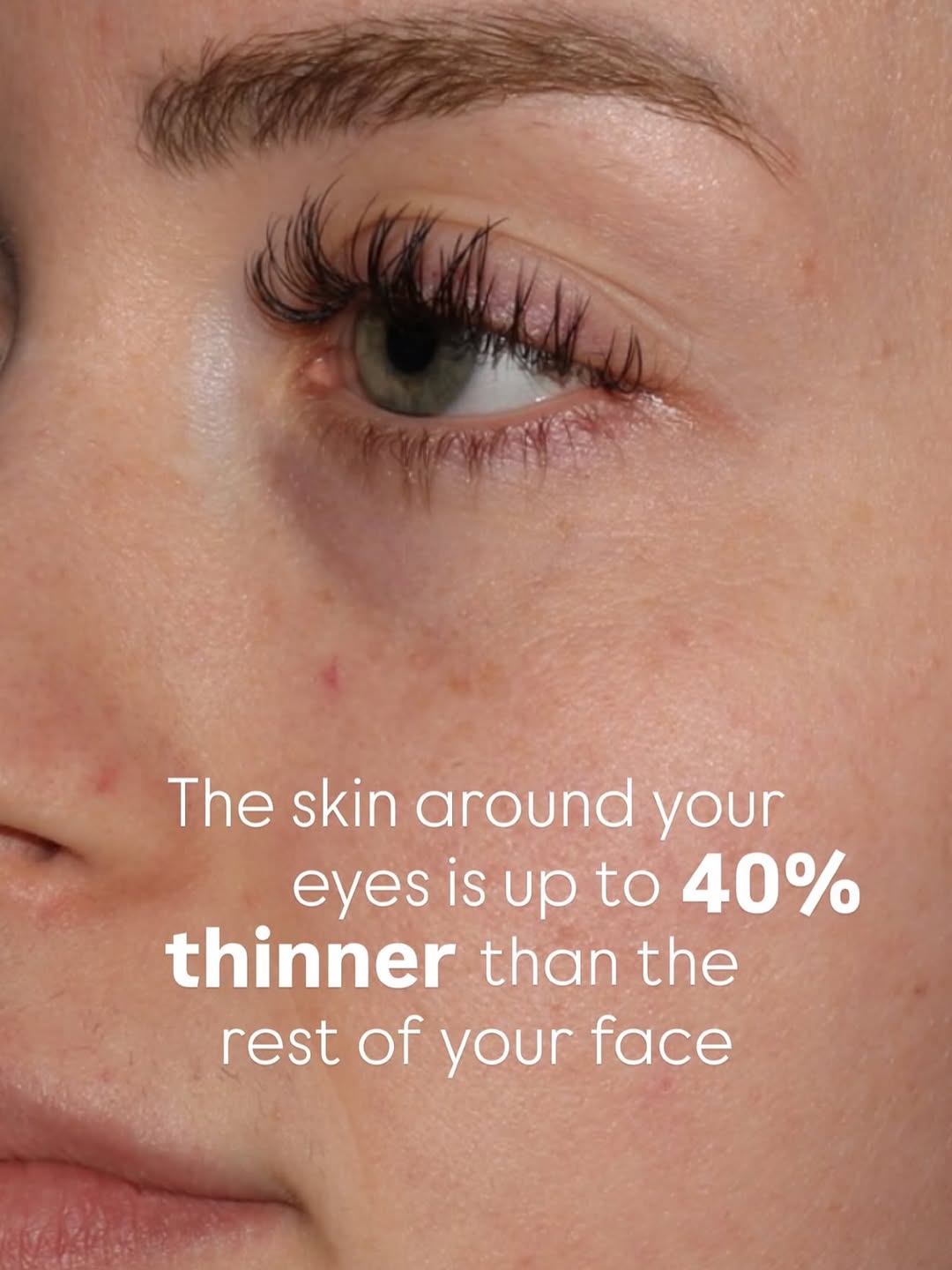 Instagram post by Dr. Richard Burgmeier: Whether you’re looking to prevent early signs of aging or maintain results after aesthetic treatments, a medical grade eye treatment can mak…