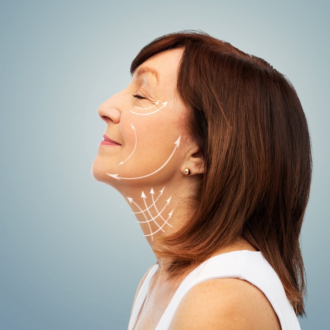 Instagram post by Dr. Richard E. Tepper: Considering a facelift? Before you take the leap, check out our latest blog post where Dr. Tepper shares some crucial info you need to know!…