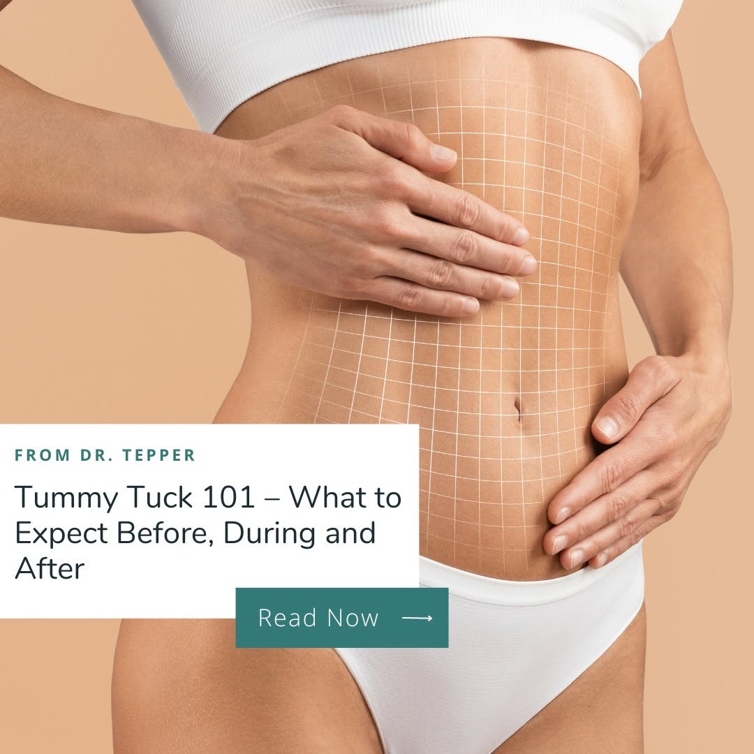 Instagram post by Dr. Richard E. Tepper: Struggling with loose skin post-weight loss or pregnancy? Tummy tucks are designed to give you the flat, toned stomach you're looking for. B…