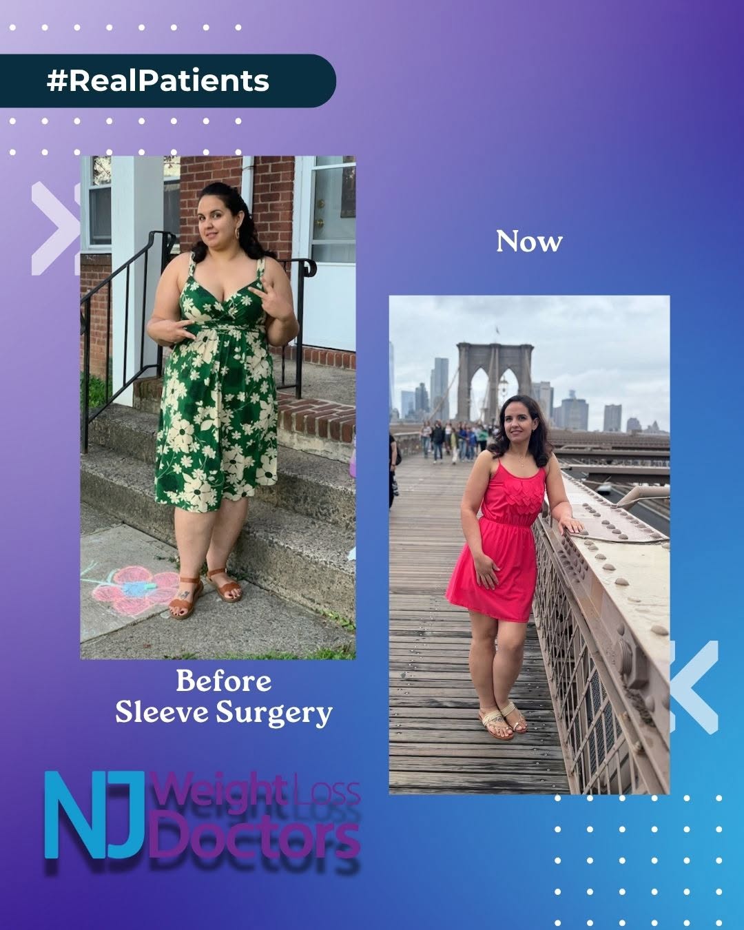 Instagram post by Dr. Richard Greco: Transformation Thursday! Look at her amazing progress after bariatric surgery with Dr. Kevin Bain. We’re so proud of her journey toward a he…