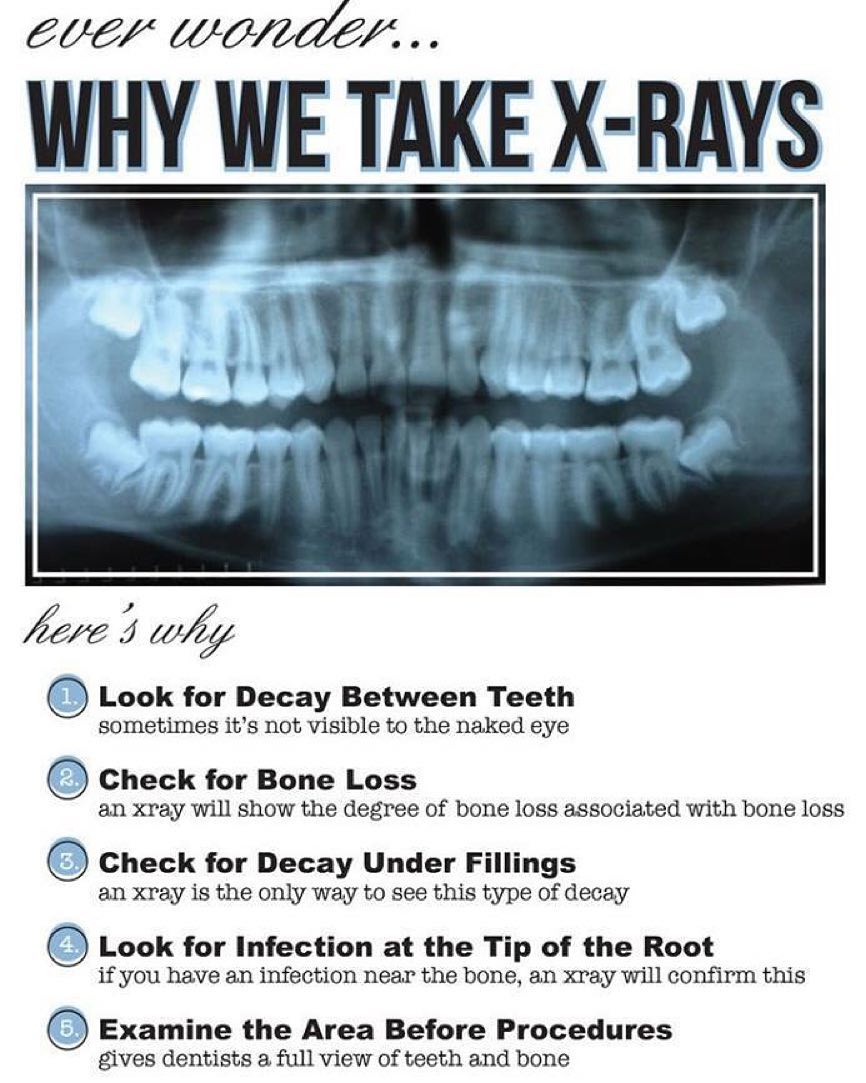 Instagram post by Dr. Ricky Lane, DDS: #DentalHealth #OralHealth #Xrays