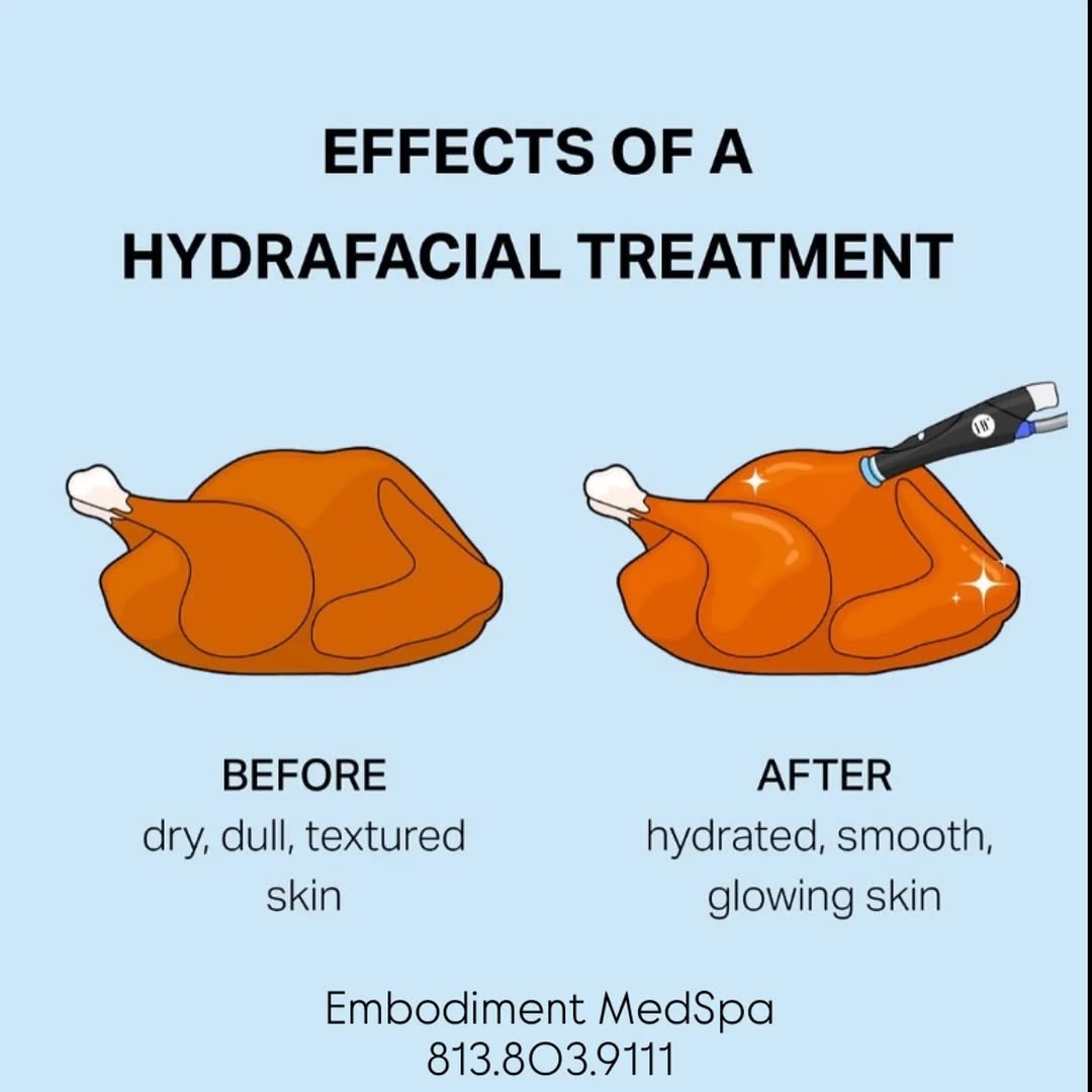 Instagram post by Dr. Rigo J. Mendoza: Don't go through another holiday without a glow up! Ask about our holiday BOGOs! • • #hydrafacialtampa #tampamedspa #bogotampa #facialtampa