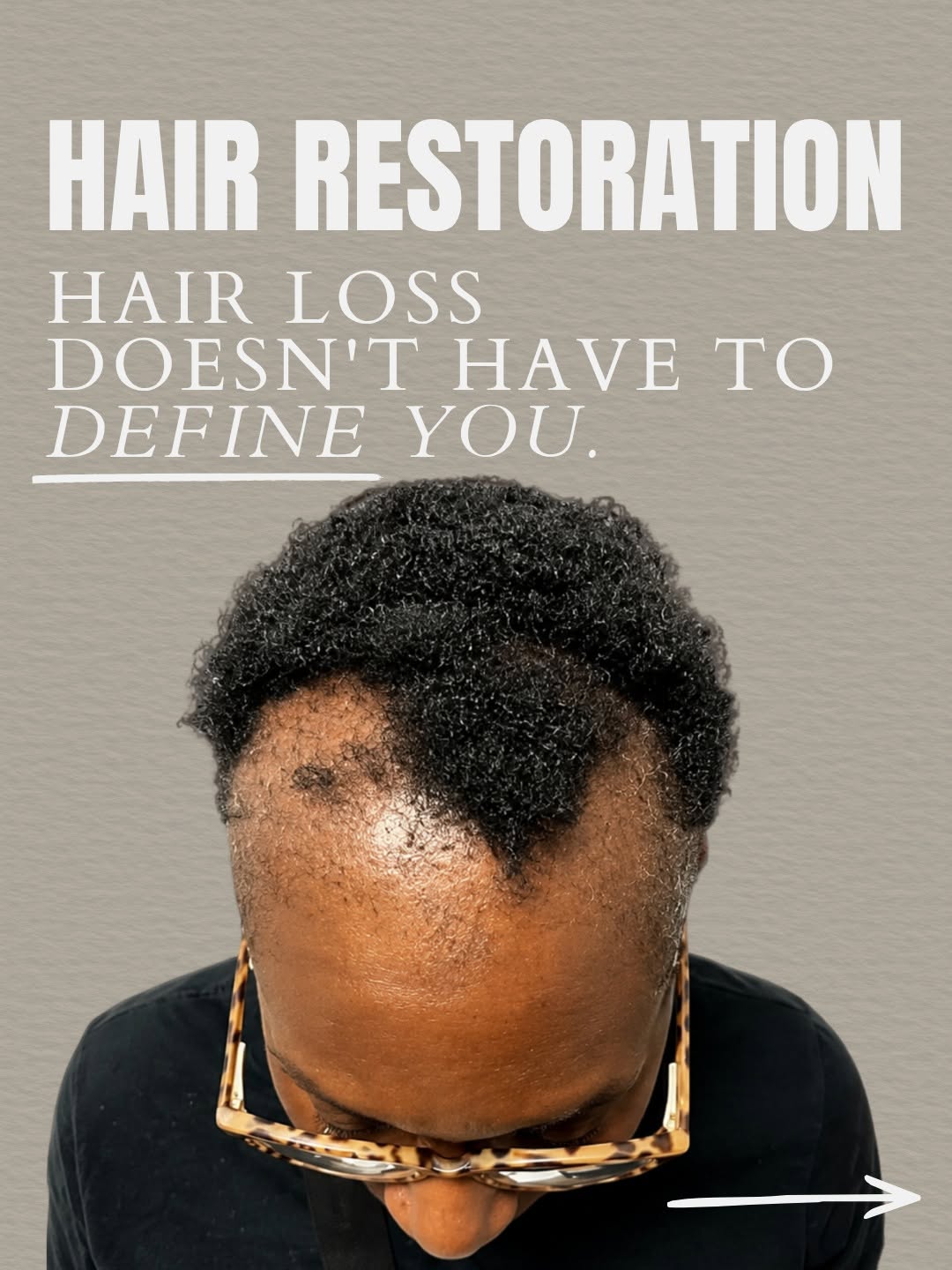 Instagram post by Dr. Robert Colgrove, Jr.: Hair loss affects both men and women, but it doesn't have to be permanent. From PRP treatments to advanced hair restoration procedures, our …