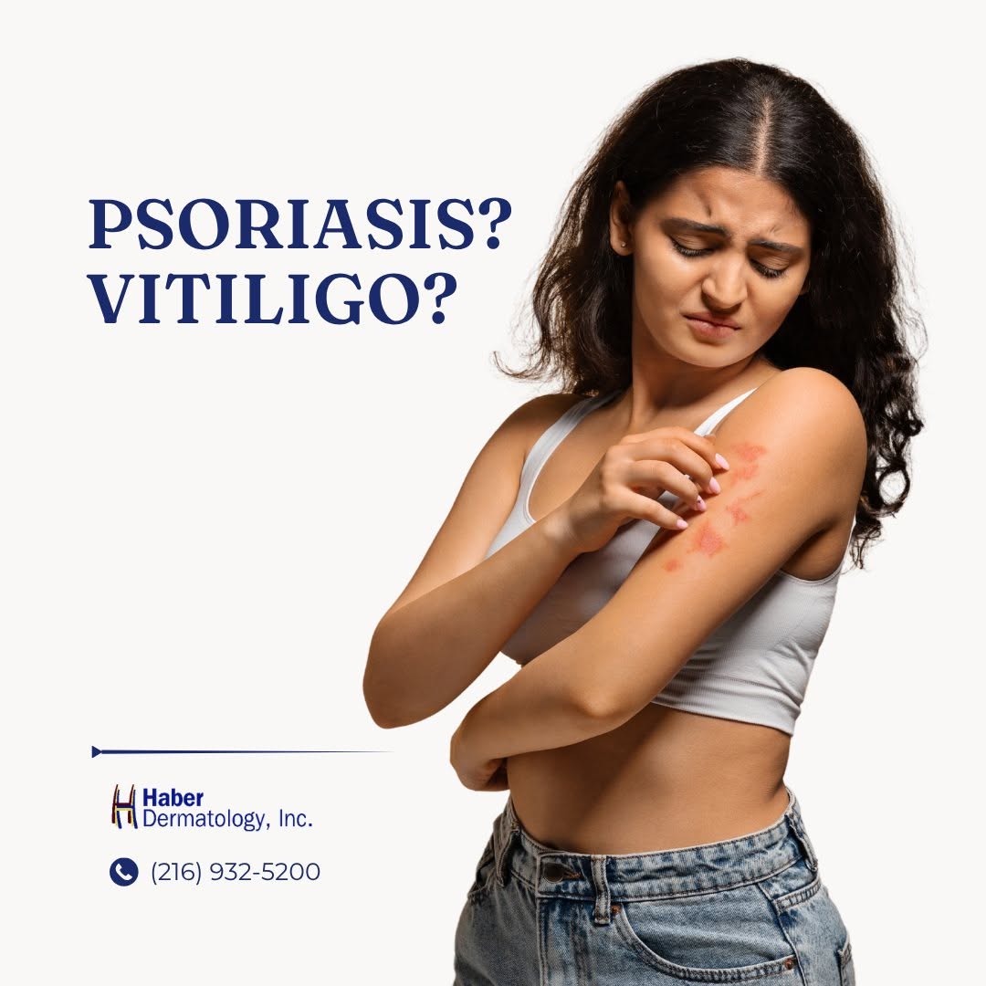 Instagram post by Dr. Robert Haber: Living with psoriasis or vitiligo? You don't have to manage it alone. Haber Dermatology has decades of experience treating these complex ski…