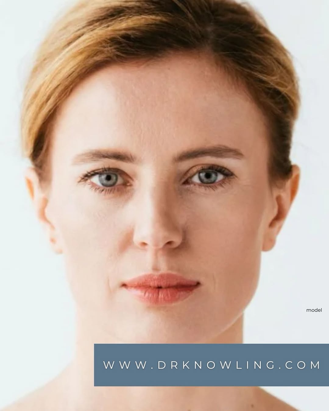 Instagram post by Dr. Robert J. Knowling: Juvederm Volbella XC is an FDA-approved injectable gel filler that increases fullness in the lips and softens the appearance of lines around…