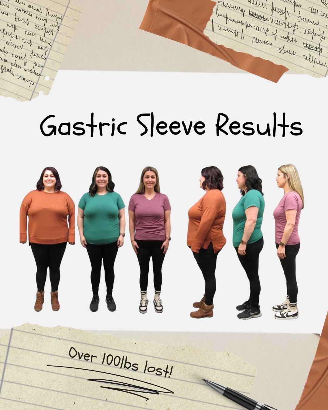 Instagram post by Dr. Robert L. Michaelson: Monday Morning Motivation! Katie struggled with her weight for years. After seeing the success her friend had from having bariatric surgery,…