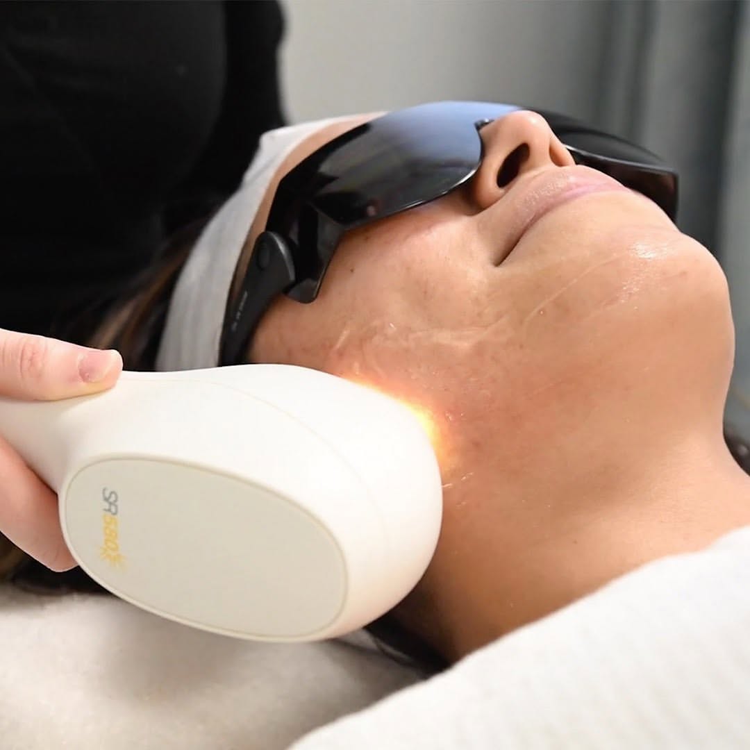 Instagram post by Dr. Robert M. Freund: I.P.L. is a non-surgical laser treatment that can address multiple pigmentation problems including dark spots, red spots, and redness on the…