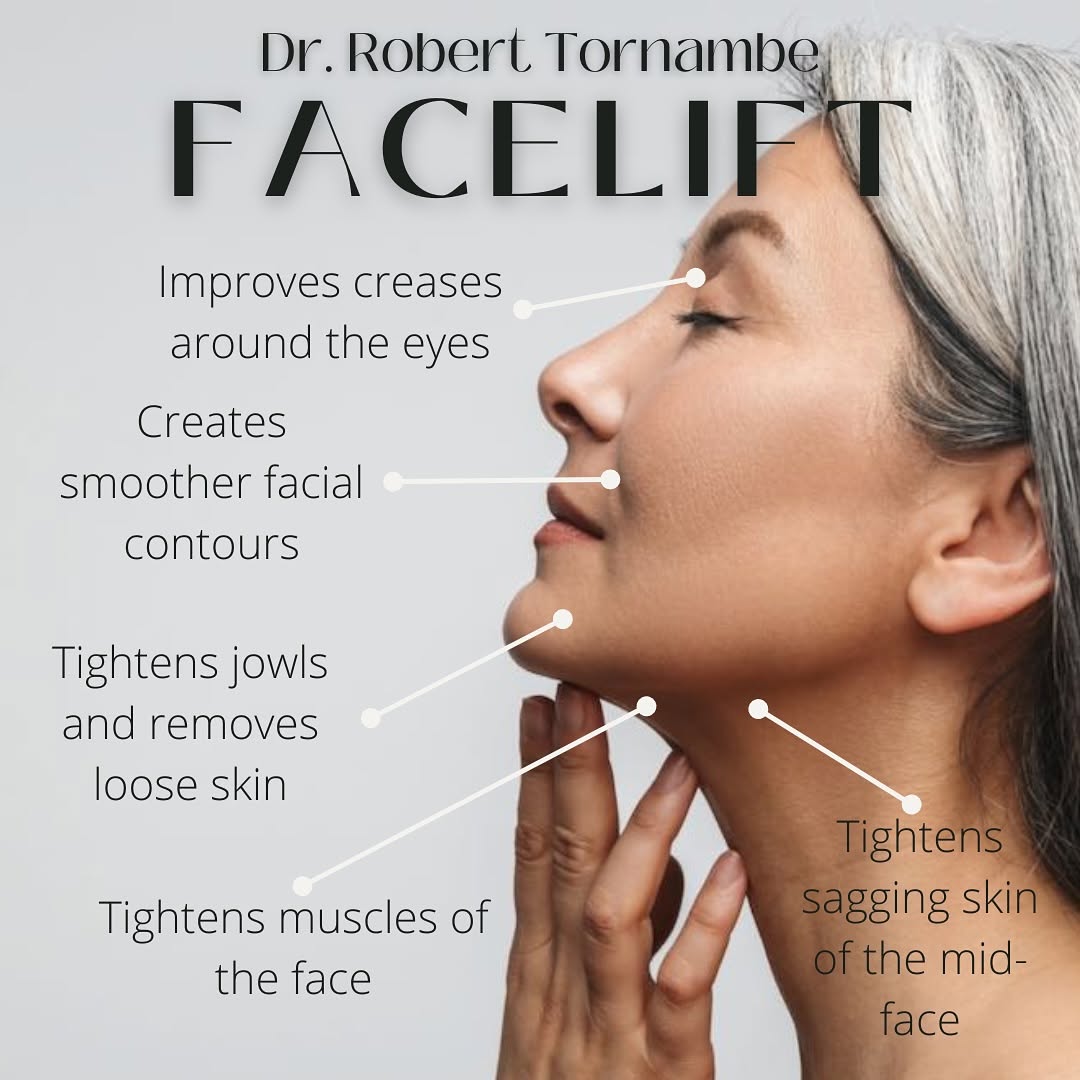 Instagram post by Dr. Robert M. Tornambe: Reverse the signs of aging and define your jawline with a Facelift by Dr. Tornambe👏🏼 You may benefit from a Facelift if you have: 👉🏻Sagg…