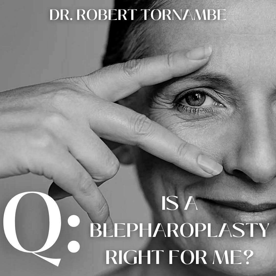 Instagram post by Dr. Robert M. Tornambe: A blepharoplasty may be beneficial if you have tired looking eyes, puffy eyelids, or excess skin around your eyes. The procedure removes the…
