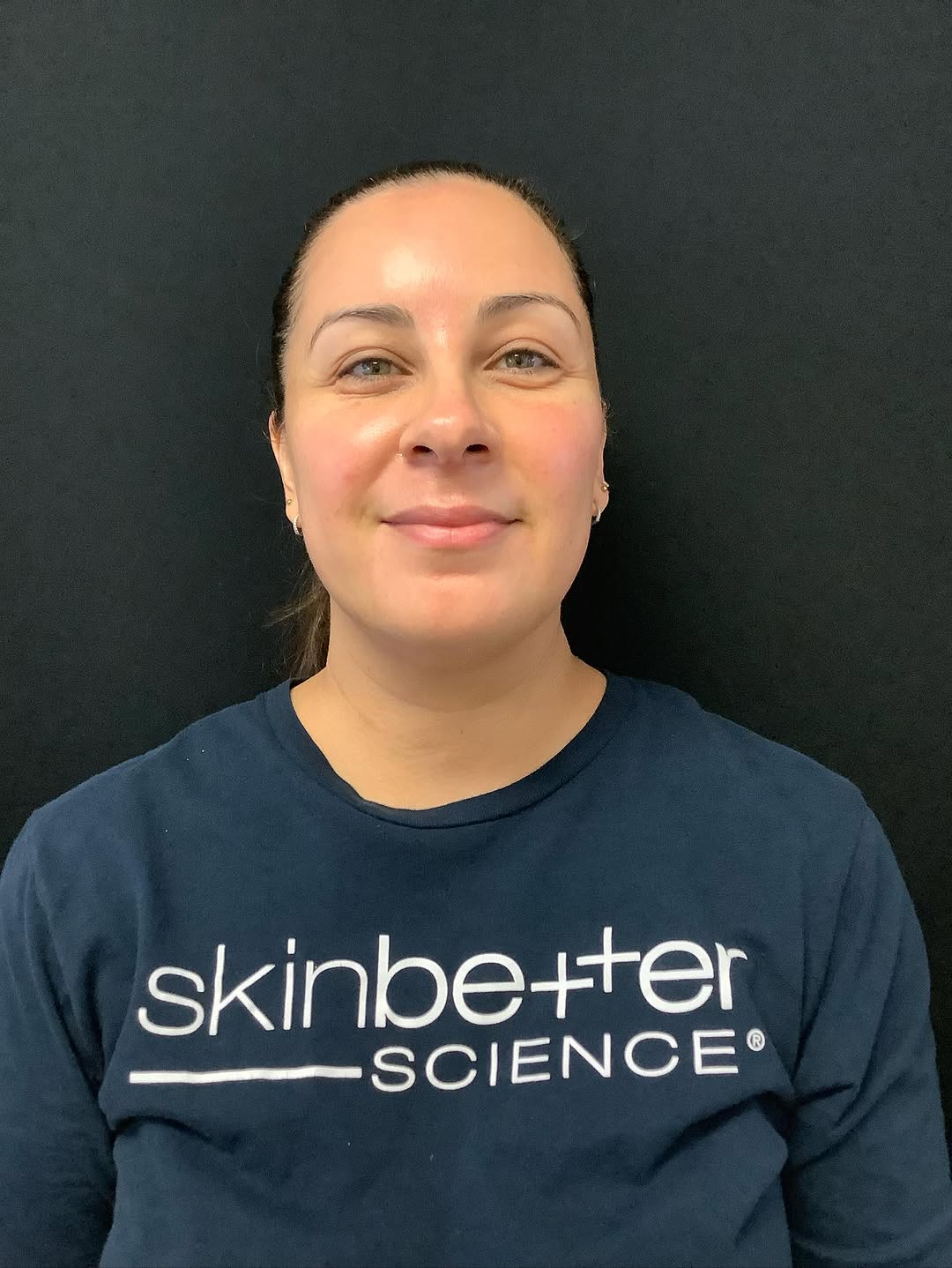 Instagram post by Dr. Robert M. Wald, Jr.: One hour post laser treatment with Exosomes. Get $100 off your next Sciton laser treatment. Schedule your appointment now. . . . . To scheduโฆ