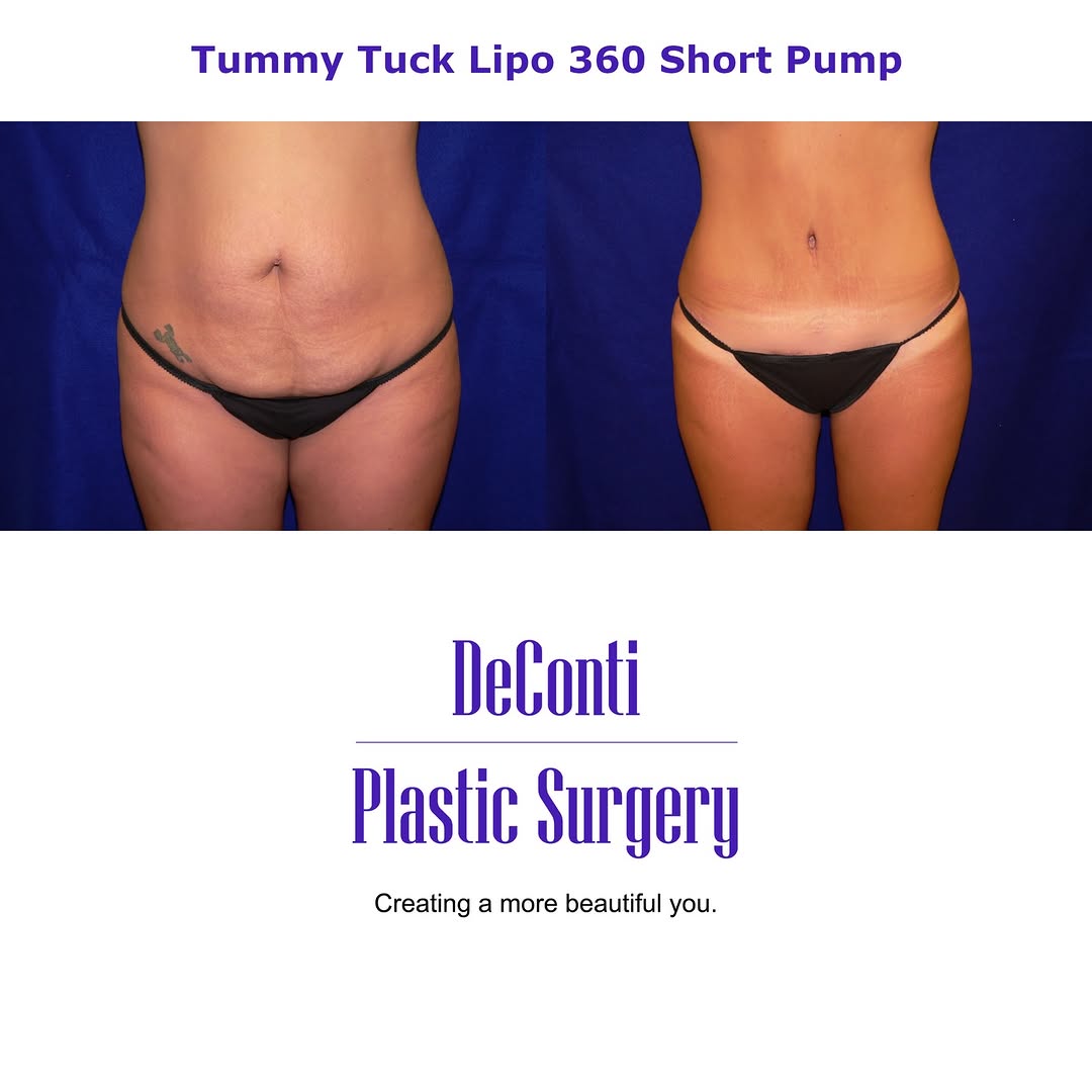 Instagram post by Dr. Robert W. DeConti: 🌙 What you secretly Google at 11pm says everything.” Like: 👉 “Is a tummy tuck worth the pain?” 👉 “Can I hide recovery from my family?” 👉…