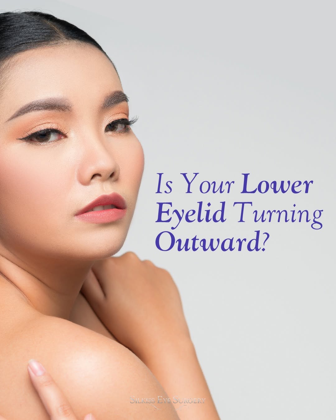 Instagram post by Dr. Rona Z. Silkiss: Is your lower eyelid pulling away from your eye? It could be ectropion—also known as a turned-out eyelid. 👀 While it's more common as we ag…