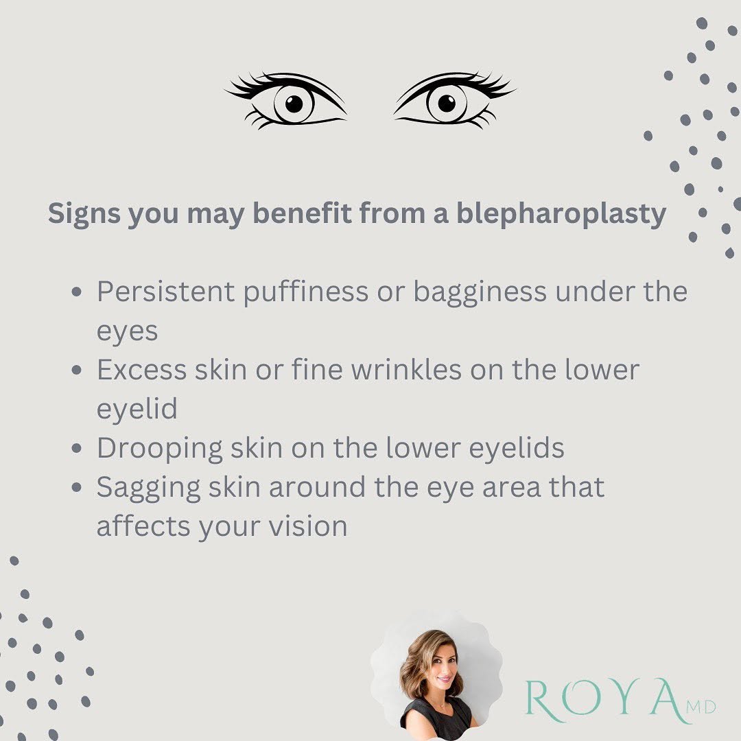 Instagram post by Dr. Roya Ghafouri: Wondering if it’s time for a blepharoplasty? These signs may help. Learn more by calling Dr. Roya’s offices for a consultation 📞 310-990-09…