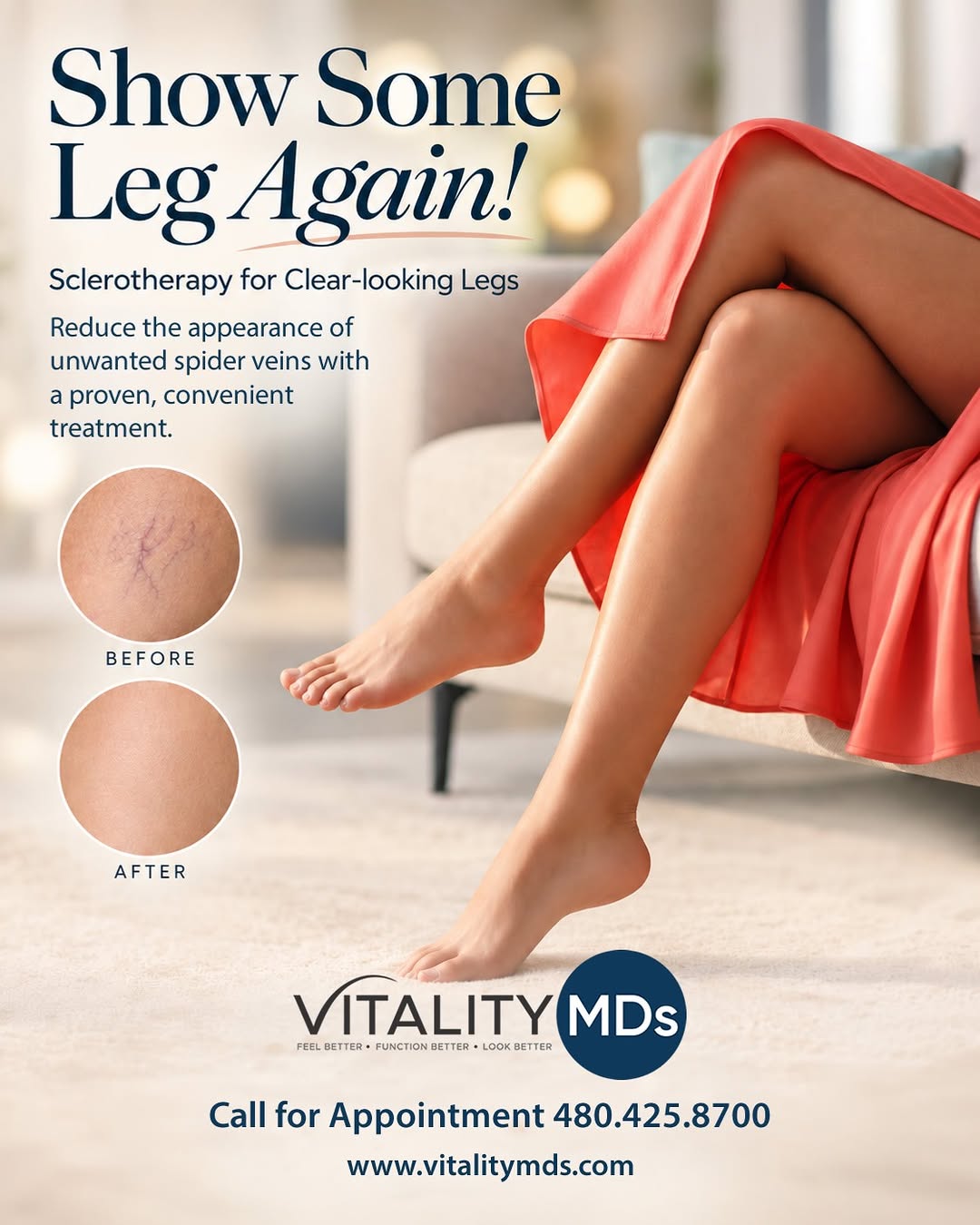 Instagram post by Dr. Russell Bartels: Remove Spider Veins with Sclerotherapy Ready to feel more confident showing off your legs? 🦵✨ Sclerotherapy is a proven, convenient treatme…