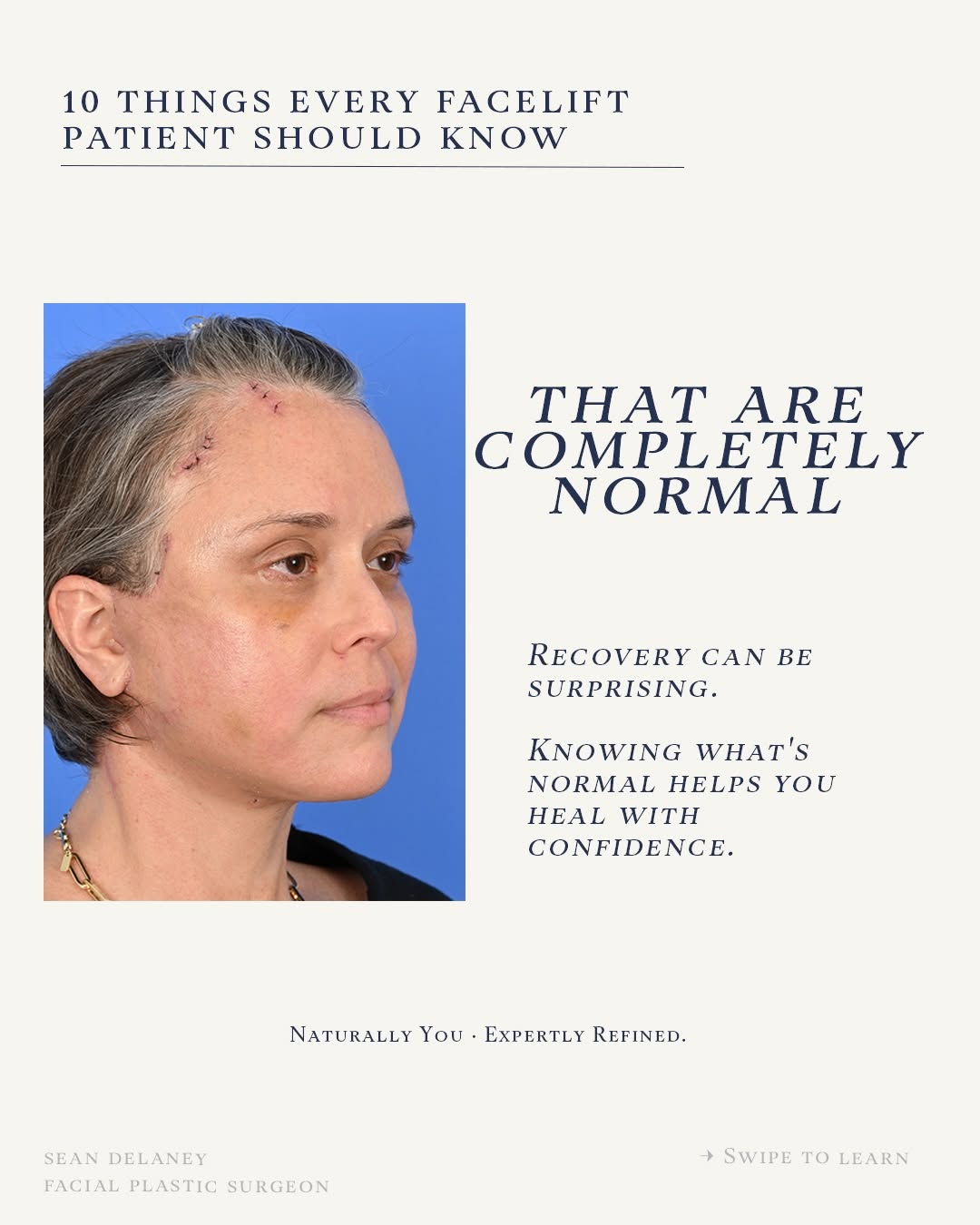 Instagram post by Dr. Russell Kridel: Recovery after a facelift is often more emotional than patients expect—not because something is wrong, but because healing takes time. Swell…